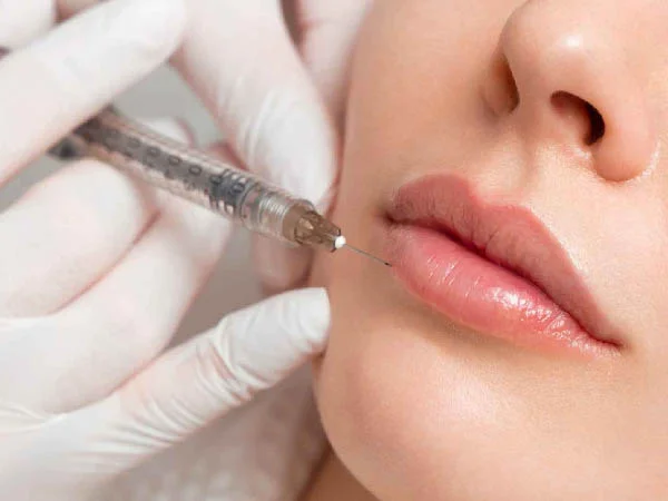 Preenchimento Labial - procedimento